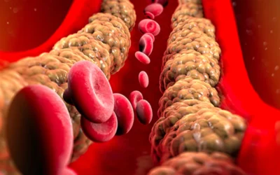 Cholesterol Verlagend Dieet -10 Tips om Cholesterol te Verlagen