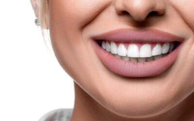 Whitify review – Is de Whitify tandenbleekset het geld waard? Lees mijn eerlijke review!